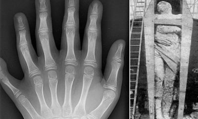 Civilizaciones perdidas y el fenómeno de los "Seis Dedos"