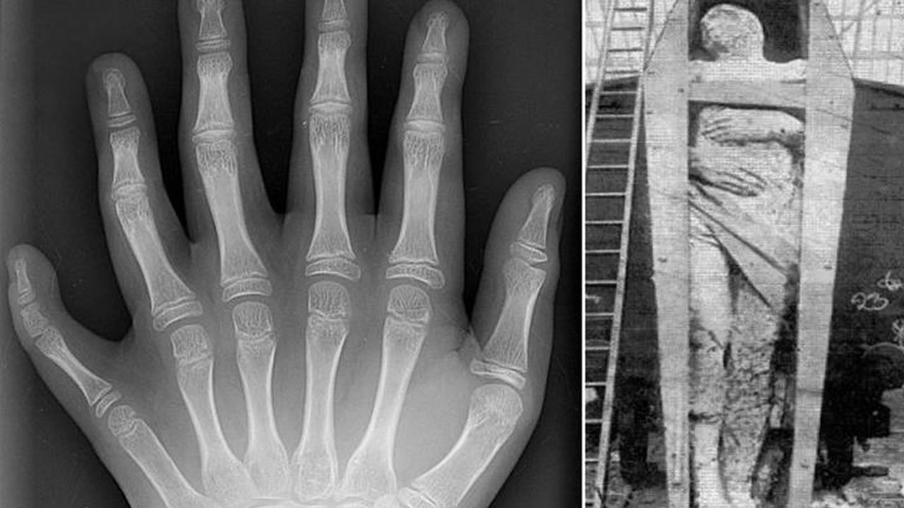 Civilizaciones perdidas y el fenómeno de los "Seis Dedos"