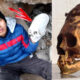 Cráneos alargados de 3.000 años en Paracas, Perú pertenecen a una "raza humana desconocida"