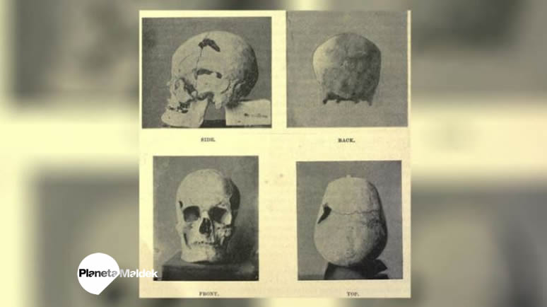 Aquí se muestra el supuesto cráneo del antiguo faraón egipcio Sanakht