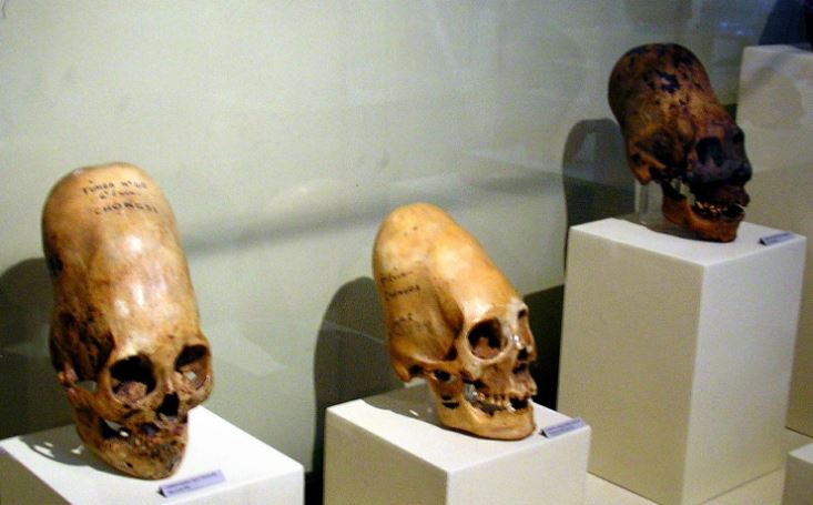 Estos cráneos están en exhibición en el Museo Regional de Ica en la ciudad de Ica en Perú